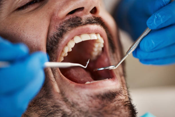 Best Weekend Emergency Dentist in Roxboro, NC